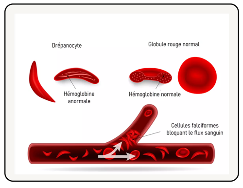 Globules rouges